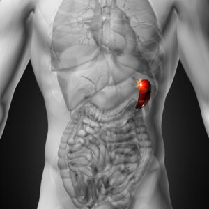 ITP patient perceptions on splenectomy outcomes